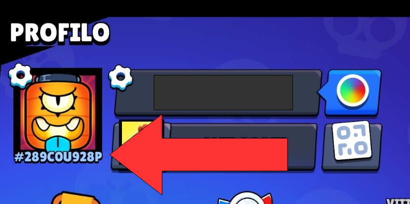 bs